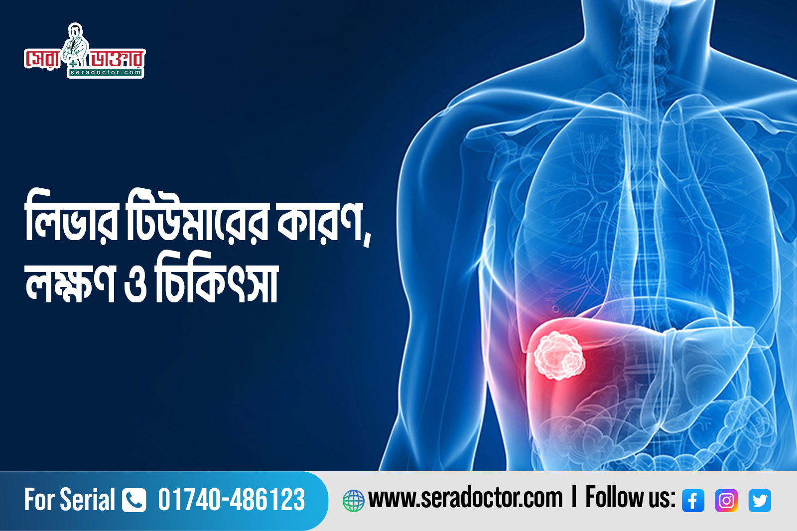 লিভার টিউমারের কারণ